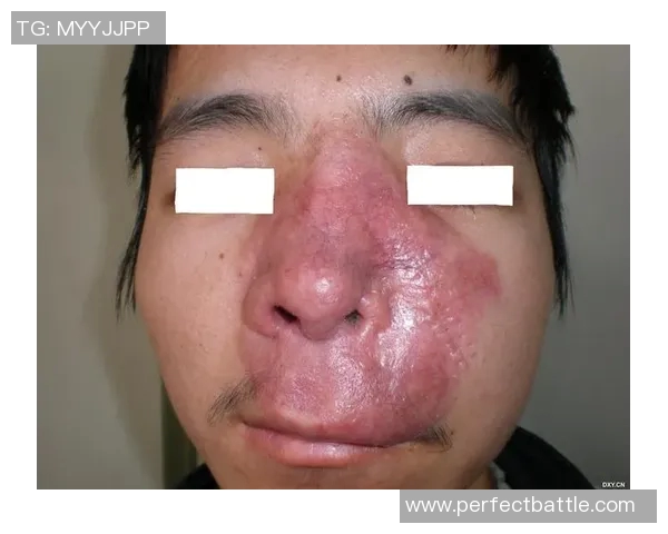 姚明去世原因揭秘罹患何种疾病引发广泛关注与讨论